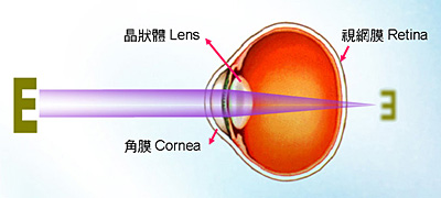 Far-sightedness